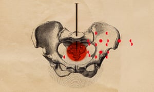 Illustration by Matthew Richardson