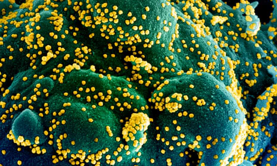 A cell infected with coronavirus