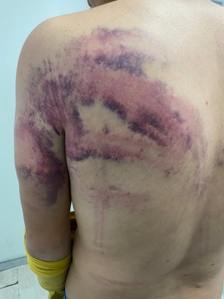 Asylum seeker were allegedly beaten at the Bosnian-Croatia border.