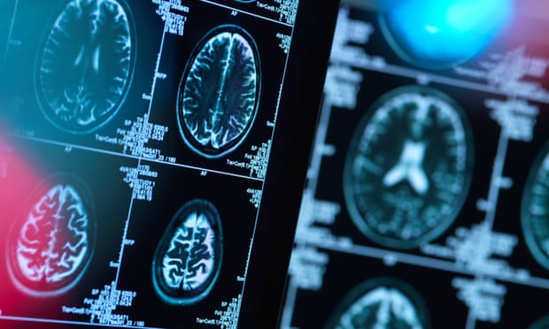 Brain scans of possible disease or damage in a clinic.