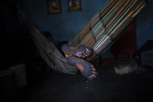 Resting in a hammock, a fishermen’s feet are covered with oil
