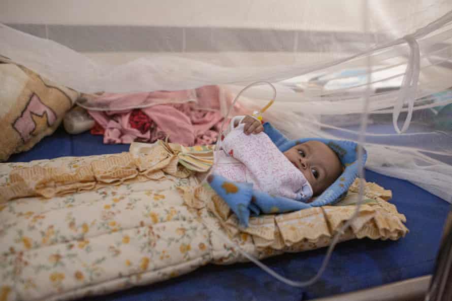 Four-month old Sara Nasser in Ataq general hospital