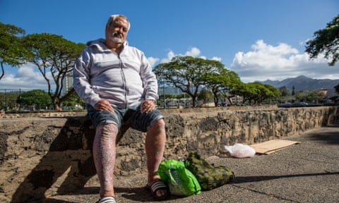 Stephen Williams, a homeless man in Honolulu who was taken to hospital last month with a life-threatening staph infection.