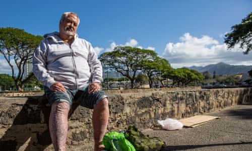 Doctors could prescribe houses to the homeless under radical Hawaii bill