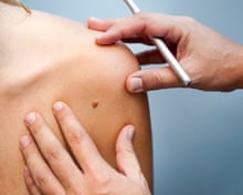 epitan melanotan Australian tanning treatment seeks London backers | Business