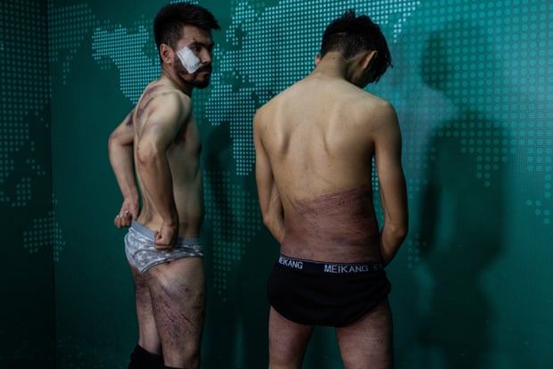 Nehmatullah Maqdi, 28, and Taqi Daryabi, 22, video journalists with the EtilaatRoz newspaper, were beaten by the Taliban after being detained while filming a women’s rights protest.