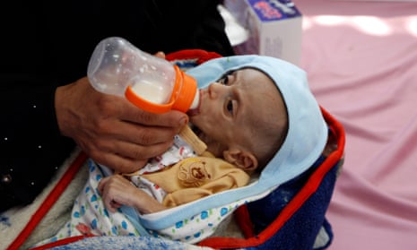 A Yemeni mother feeds her malnourished child