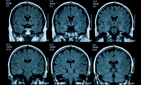 Brain power dropped among over-50s during Covid-19 pandemic, study shows