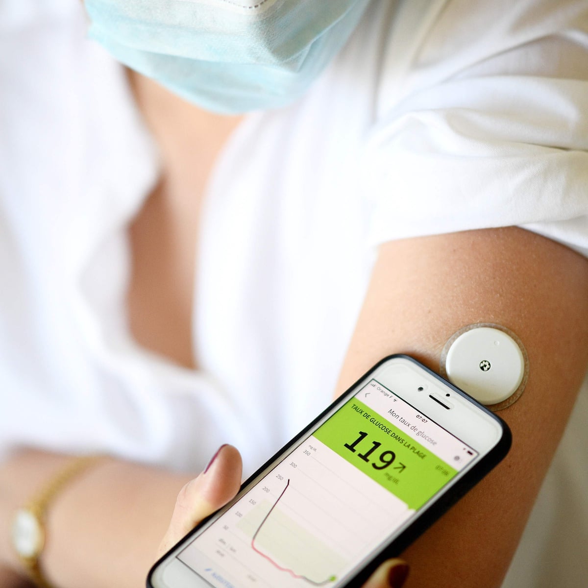 Does Humana Cover Crowns Does Humana Cover Crowns