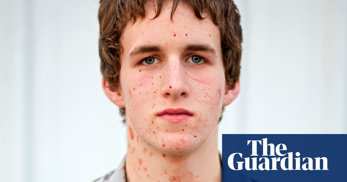 Un carnicero de pollos huterita cubierto de sangre … La mejor fotografía de Tim Smith | Fotografía Un carnicero de pollos huterita cubierto de sangre … La mejor fotografía de Tim Smith | Fotografía