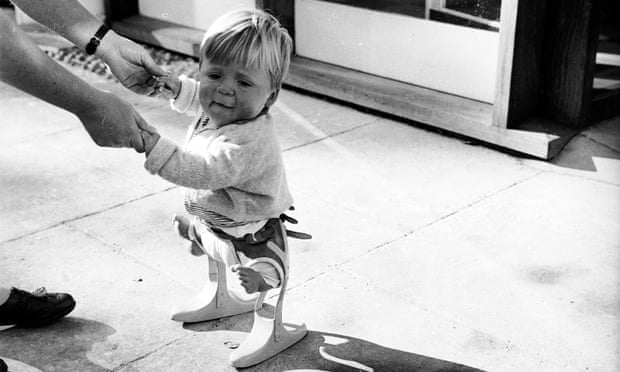 A small child affected by thalidomide in 1962.