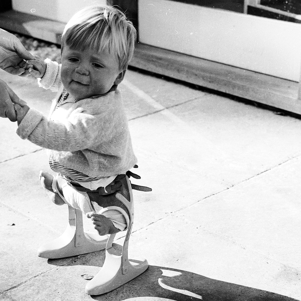 Thalidomide Caused Up To 10 000 Miscarriages And Infant Deaths In Uk Thalidomide The Guardian Thalidomide Caused Up To 10 000 Miscarriages And Infant Deaths In Uk Thalidomide The Guardian