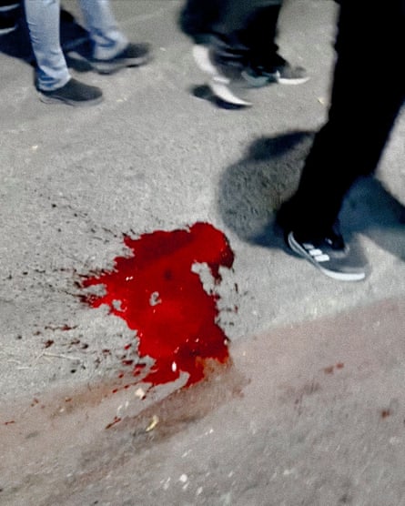 Feet standing next to a trail of blood