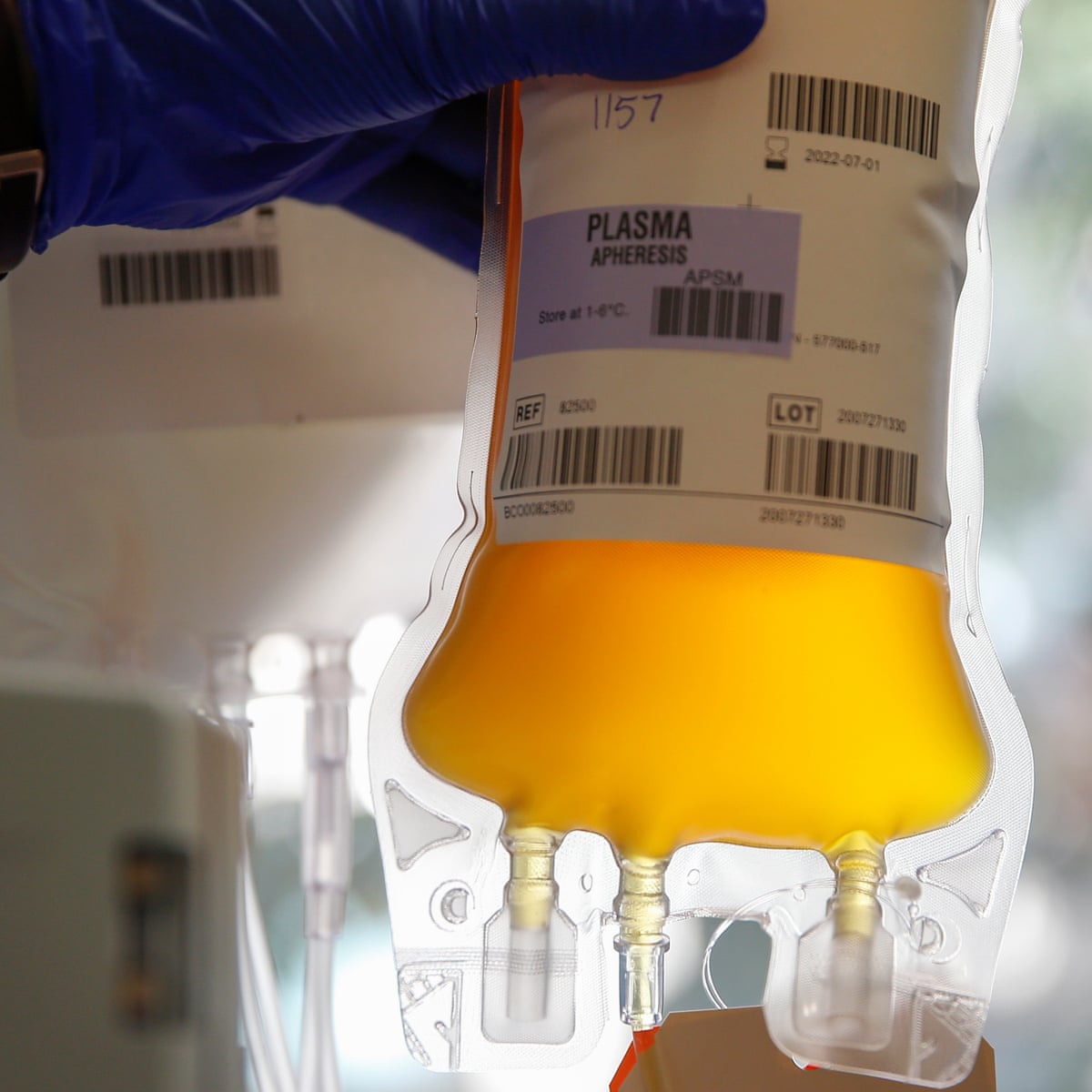 Covid 19 Blood Plasma Therapy Has Limited Effect Study Finds Coronavirus The Guardian