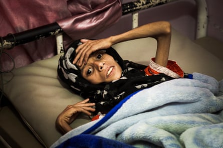 Sadia Ibrahim Mahmud, 11, at the malnutrition ward of the al-Sabeen women and children’s hospital.