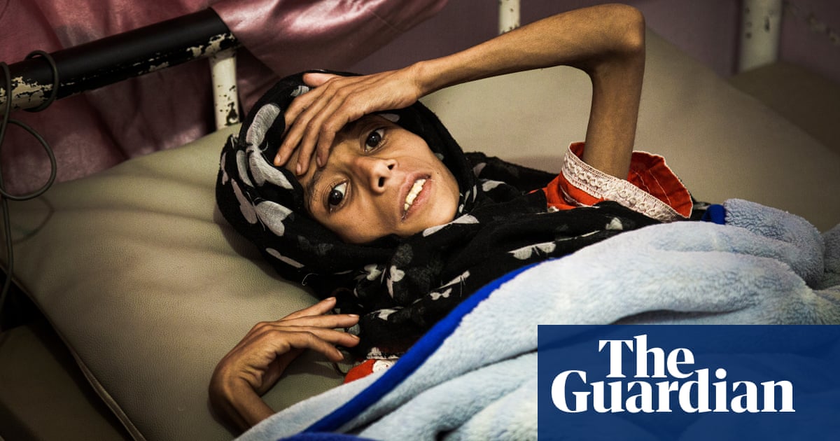 War and famine could wipe out the next generation of Yemenis