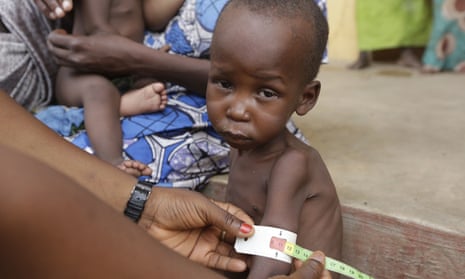 A doctor attends to a child at a refugee camp in Yola, Nigeria, last year