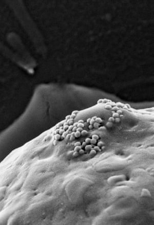 Nanoparticles: cancer cell surface