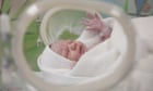 NHS England spent £4.1bn over 11 years settling lawsuits over brain-damaged babies