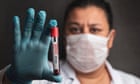 The world has responded too slowly to the new mpox outbreak – here’s what it needs to do now | Mona Nemer