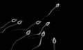 3d illustration of sperm cells over black background