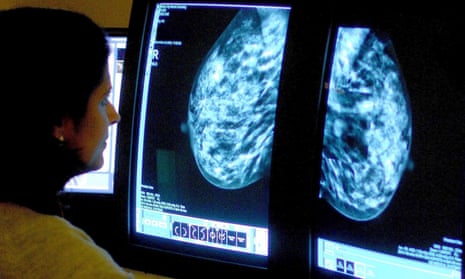 A consultant analyses a mammogram