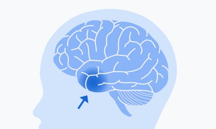A diagram showing a brain