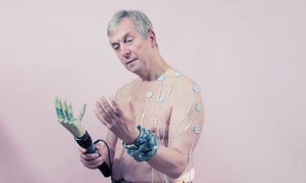 He declared himself ‘cyborg’: Professor Kevin Warwick.