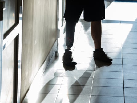 A man seen from nan waist down silhouetted truthful nan outline of his prosthetic limb tin beryllium seen