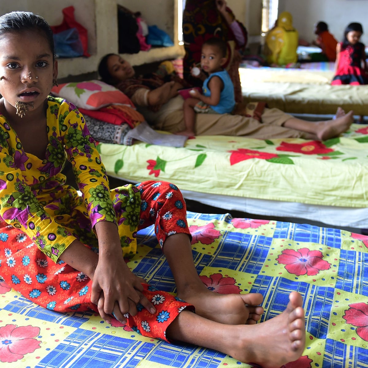 Bangladeshi Girl Could Be First Female With Tree Man Syndrome Global Health The Guardian Bangladeshi Girl Could Be First Female With Tree Man Syndrome Global Health The Guardian