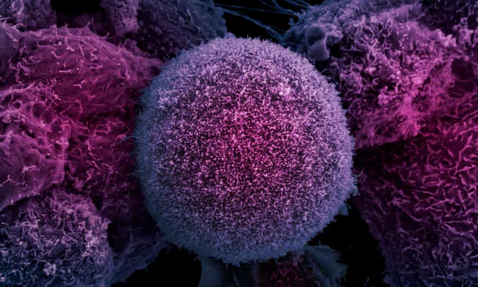 prostate cancer immunotherapy trials uk