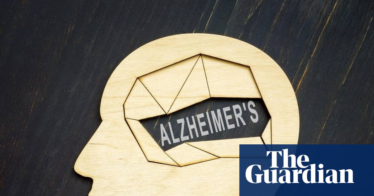 Alzheimer’s trial to test drug on people without symptoms to see if it can be prevented