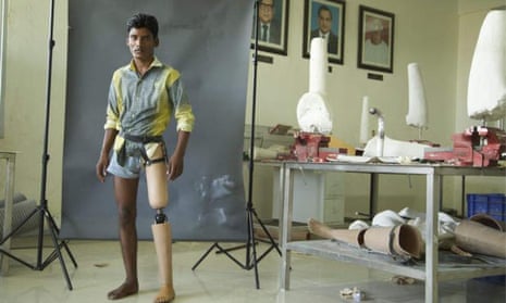 Prakash, a young patient in Jaipur, India, tries out a prosthetic leg with a D-Rev knee joint.