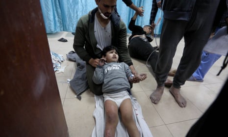 An injured Palestinian child is treated on the floor at al-Aqsa Martyrs hospital after an Israeli attack in Deir al-Balah, central Gaza.