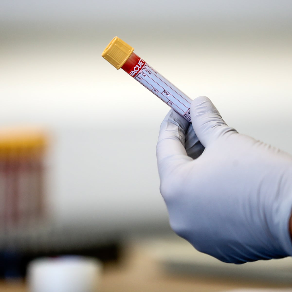 Lab Work Test Routine Blood Work Tests