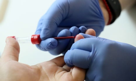 A blood test takes place