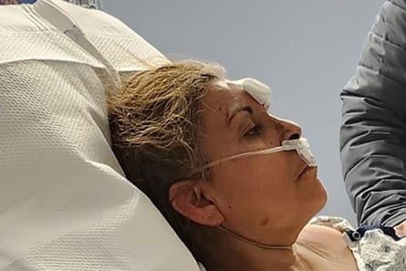 A woman lays on a pillow in a hospital bed, her face bandaged.