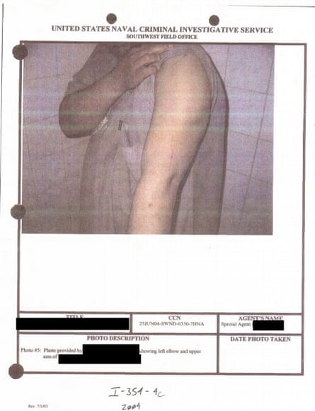 Image depicts detainee’s arm injury. No further context was provided.