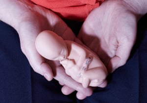 A prop used by pro-life campaigners to show pregnant women considering abortion the size of a foetus in the womb