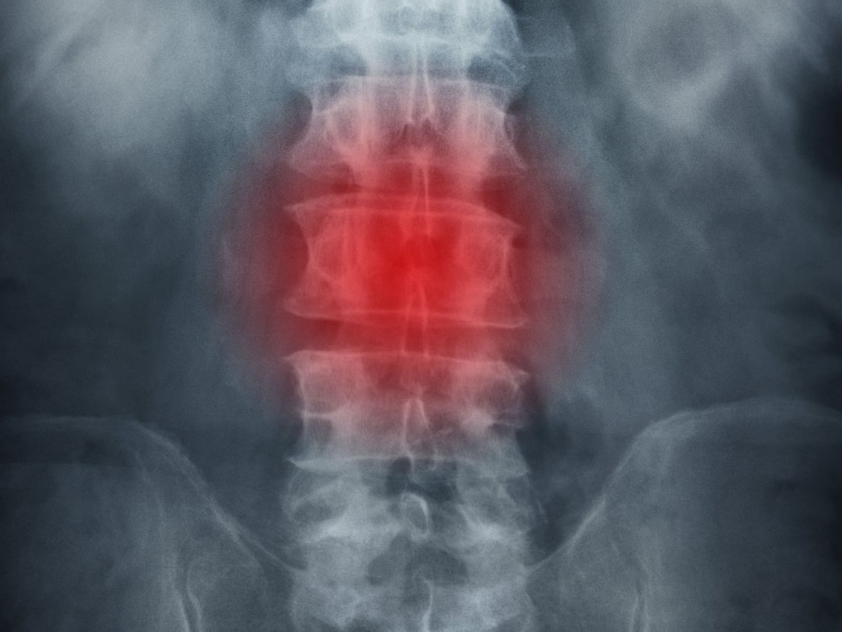 Doctors Told To Think Twice Before Signing Patients Off Work Or Ordering X Rays Health The Guardian