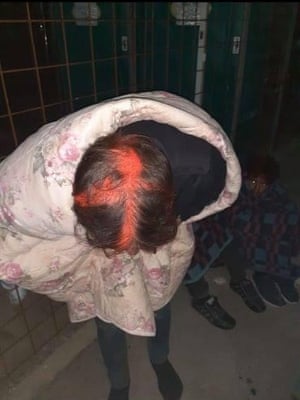 As well as being sprayed with pain, one group of migrants had their phones and money stolen; some also had their shoes taken.