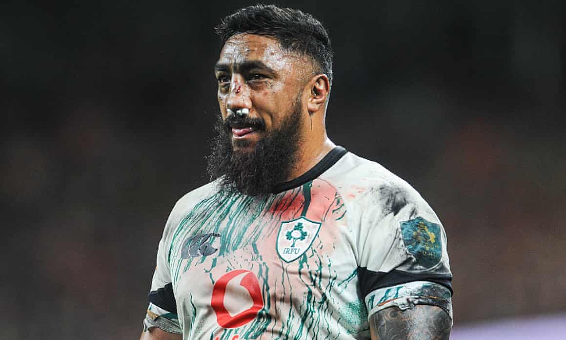 A bruised and battered Bundee Aki of Ireland.
