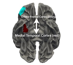 Scans Show Possible Link Between Brain >> Scans Show Possible Link Between Brain Development And Antisocial Scans Show Possible Link Between Brain >> Scans Show Possible Link Between Brain Development And Antisocial