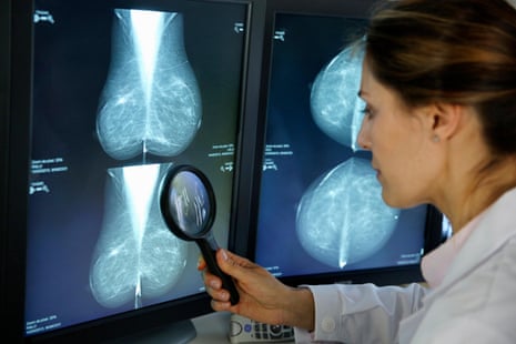 A doctor looks at mammogram results with a magnifying glass.