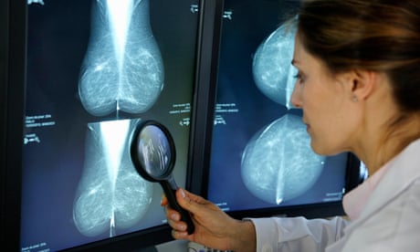 Low-income US women far less likely to receive mammograms – study