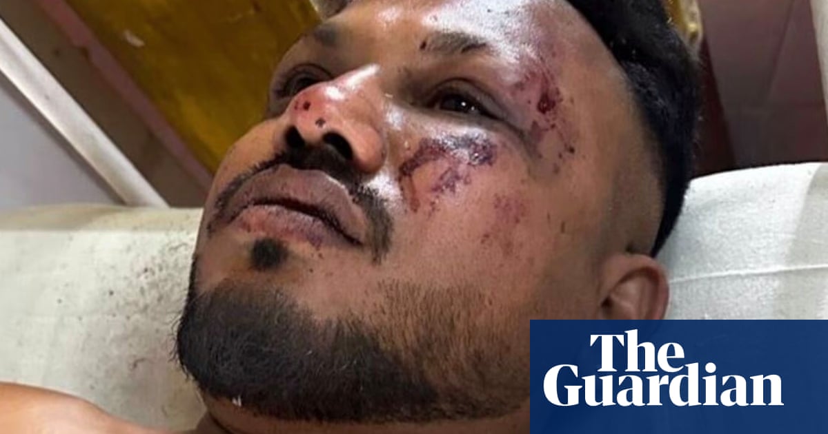 British man has no idea' how he survived Air India crash