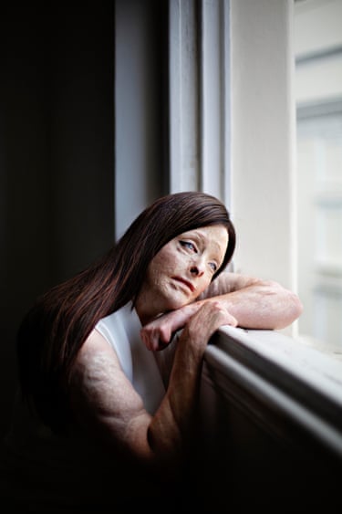 Mel (from the series On the Outside of Inside), 2024The Stockholm-born and based photographer and writer explores diversity in appearance to expose discrimination while celebrating physical difference. Her portrait of Mel is a collaboration, portraying strength through humanism and careful intention