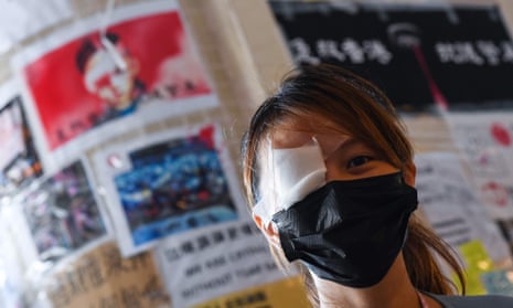 A nurse at an anti-government rally in Hong Kong with one eye covered in tribute to a fellow protester who may lose an eye after being shot with a beanbag round.