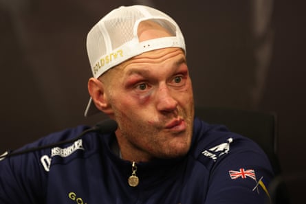 Tyson Fury during the press conference