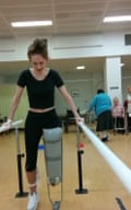 Victoria Lebrec in 2015, during recovery after losing a leg in a lorry collision